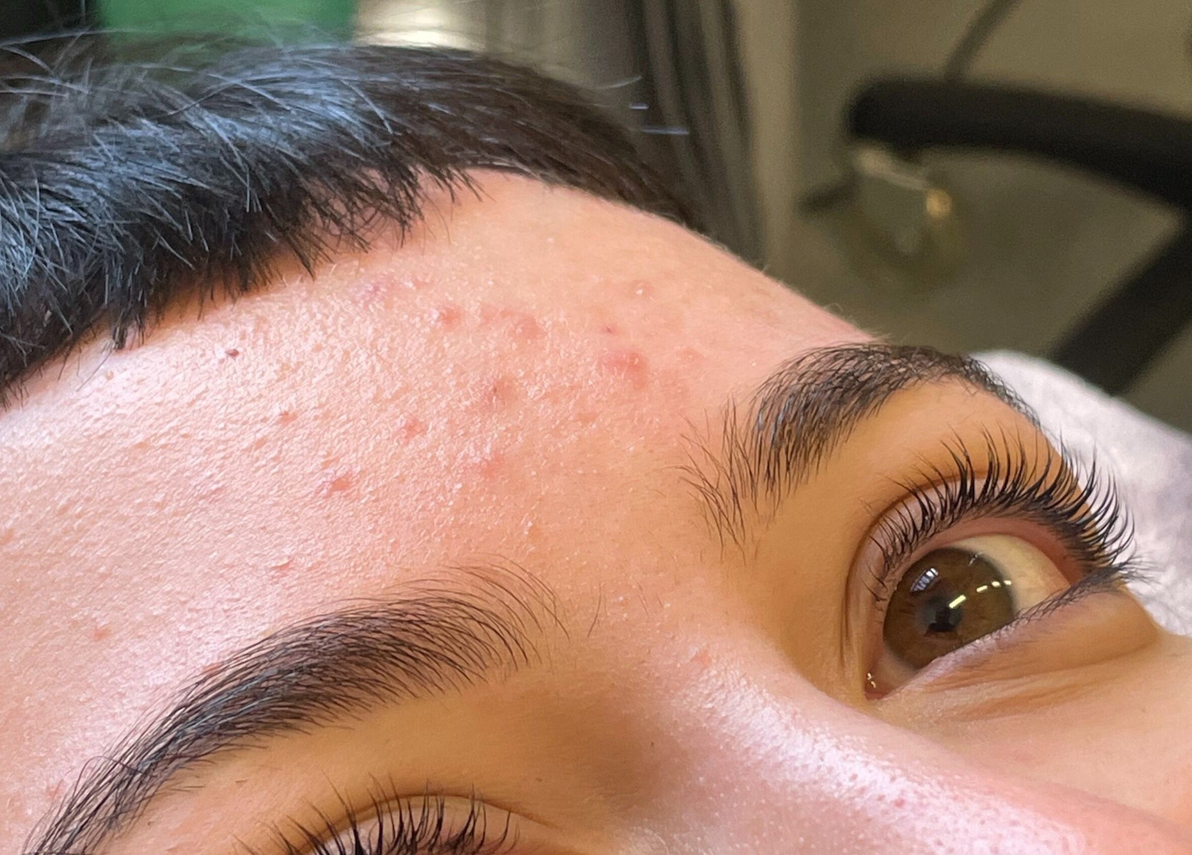 Close-up of a person's forehead and lashes post-treatment at Possession Beauty, Thirroul, New South Wales, AU.