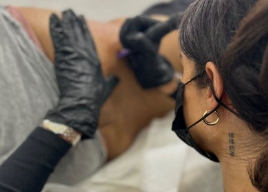 Professional tattoo artist working at Camoskin Clinic, Applecross, Western Australia, AU for precise treatment.