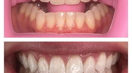 Icy Smile Bar, bilde 3