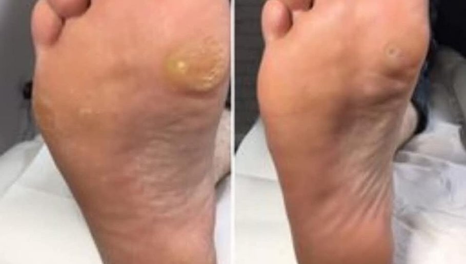 Clinique Pedimed image 1