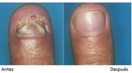 Clinique Pedimed image 3