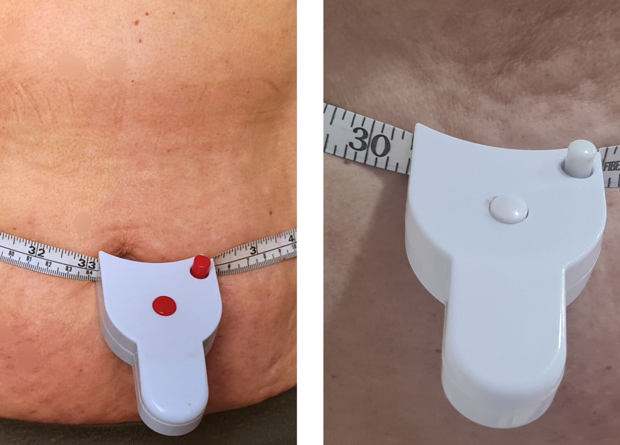 Tape measure around a waist at Finesse Wellness Clinic in Leicester, England, GB.