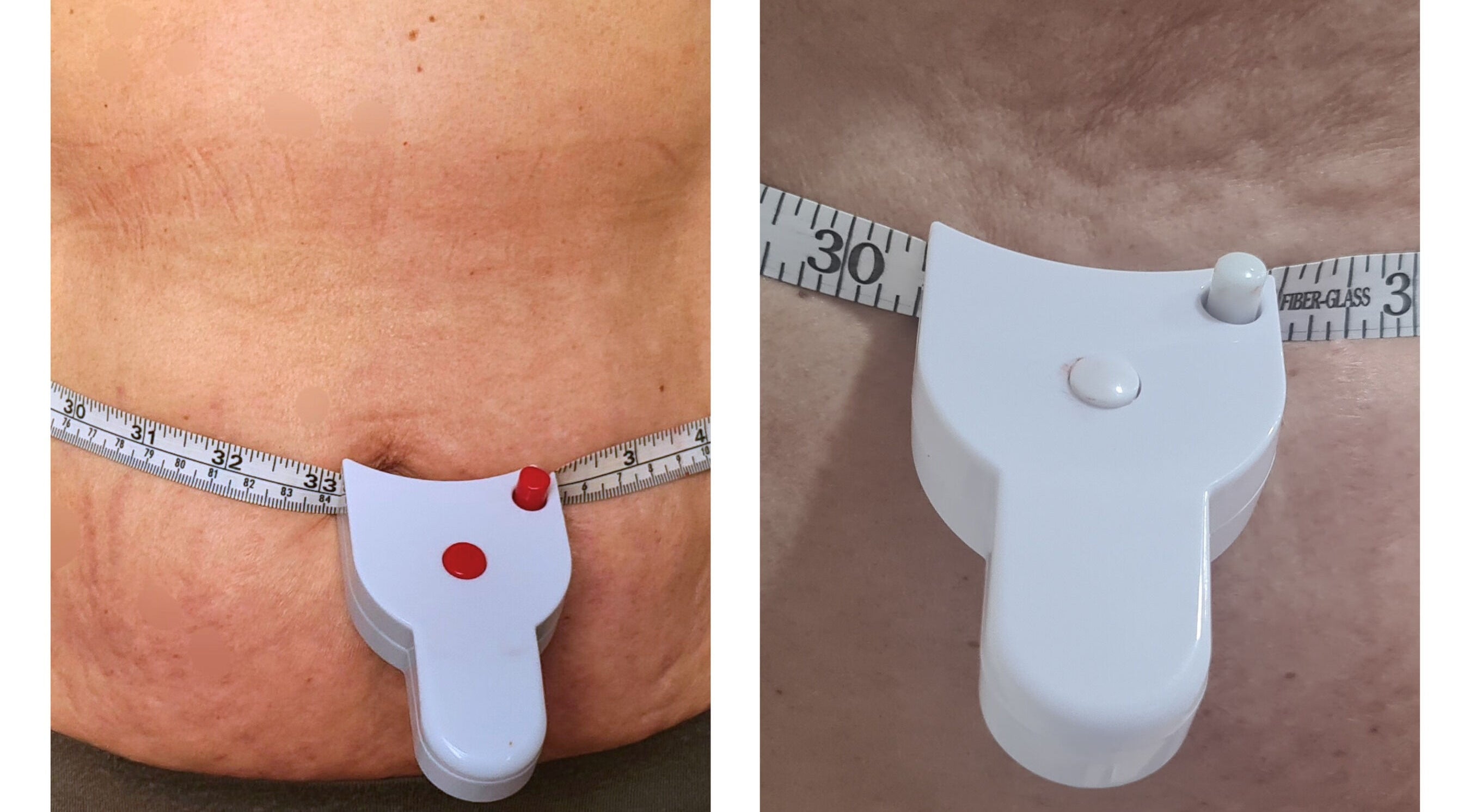Tape measure around a waist at Finesse Wellness Clinic in Leicester, England, GB.
