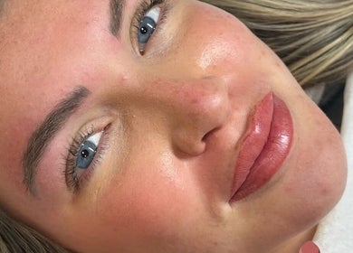 Close-up of a woman with radiant skin and enhanced lips at I D BEAUTY, Stoke-on-Trent, England, GB.