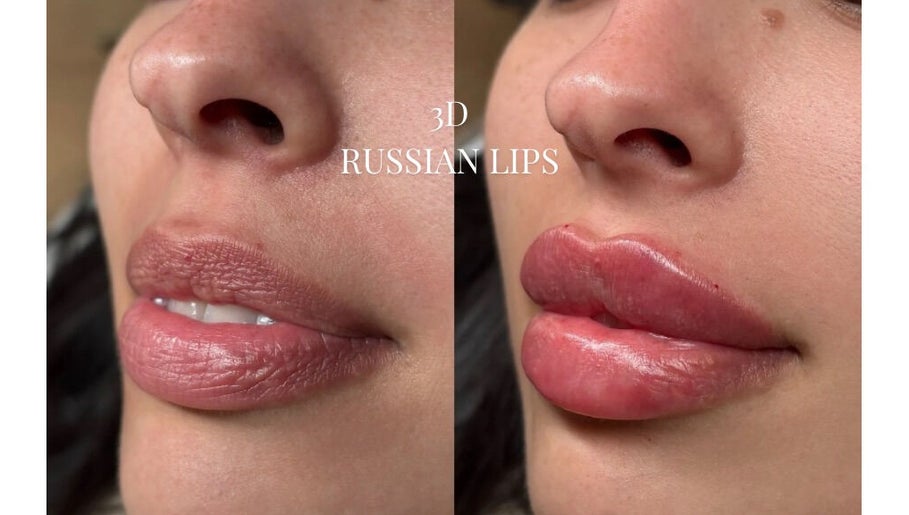 Kissed By Kyiis - Aesthetics Clinic Stockport, bilde 1