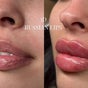 Kissed By Kyiis - Aesthetics Clinic Harlow