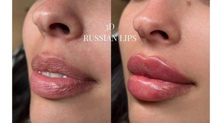 Kissed By Kyiis - Aesthetics Clinic Harlow