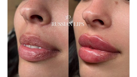 Kissed By Kyiis - Aesthetics Clinic Harlow
