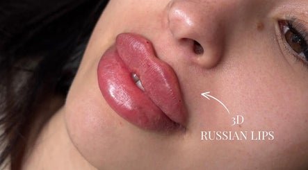 Hình ảnh 2 của Kissed By Kyiis - Aesthetics Clinic Harlow