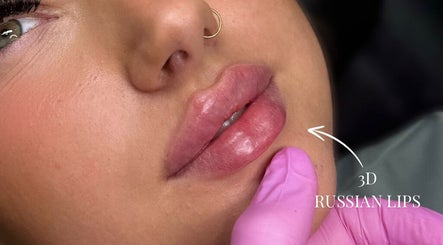 Hình ảnh 3 của Kissed By Kyiis - Aesthetics Clinic Harlow
