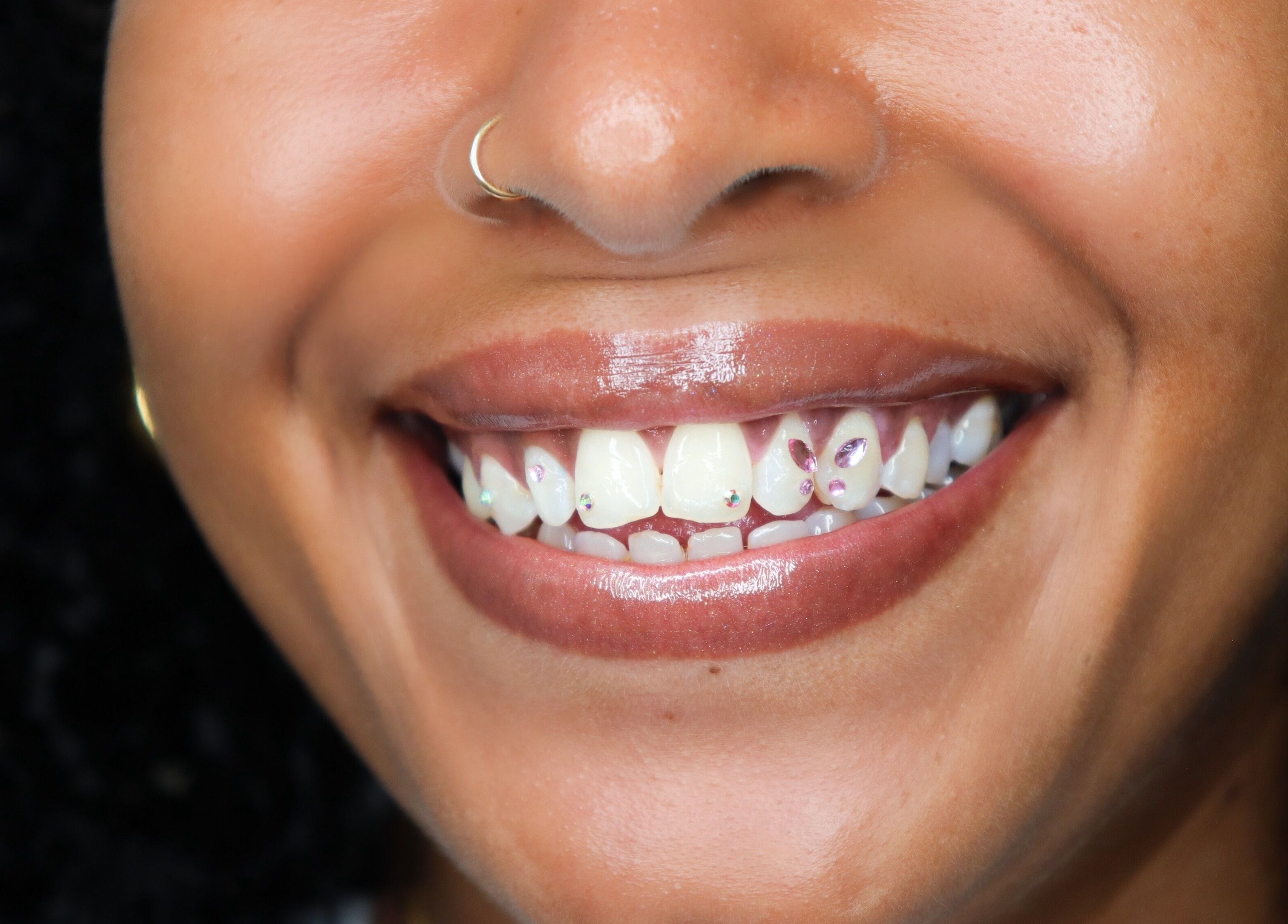 Sourire éclatant avec bijoux dentaires à LE BAR À SOURIRES, Fort-de-france, Fort-de-france, MQ.
