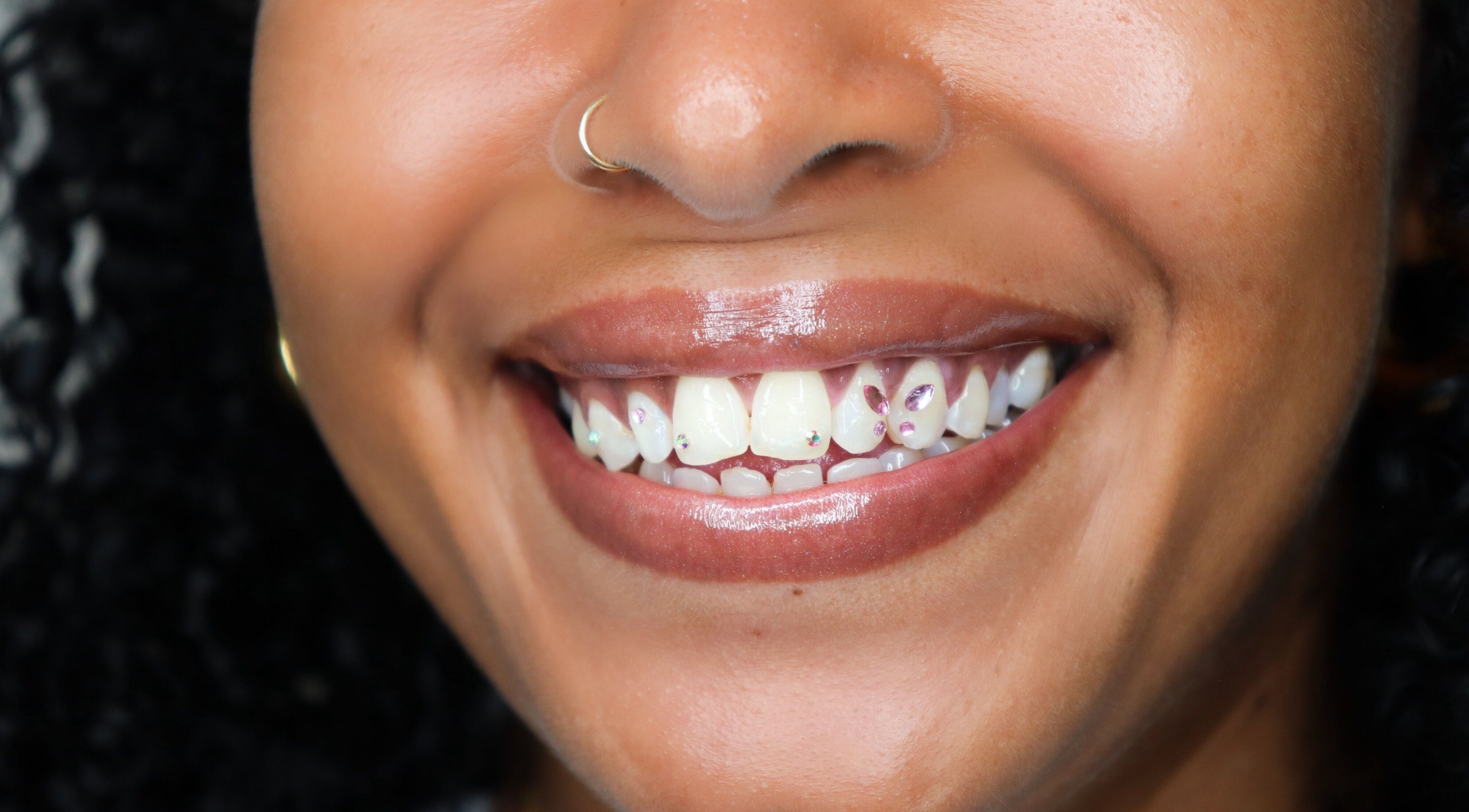 Sourire éclatant avec bijoux dentaires à LE BAR À SOURIRES, Fort-de-france, Fort-de-france, MQ.