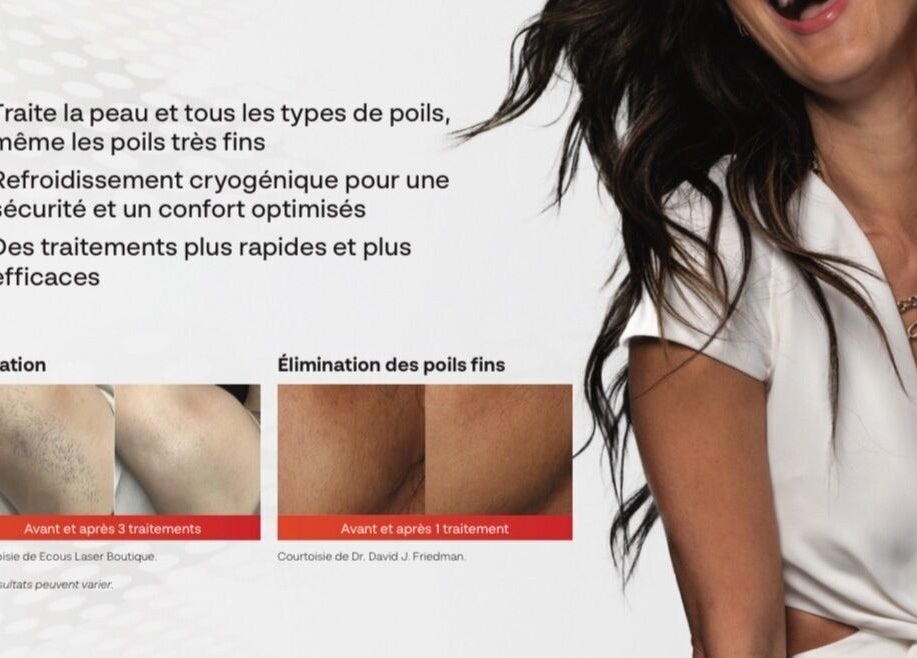 Traitement épilation avancé chez Beauté par Kristine, Laval, Québec, CA. Rapidité et efficacité garanties.