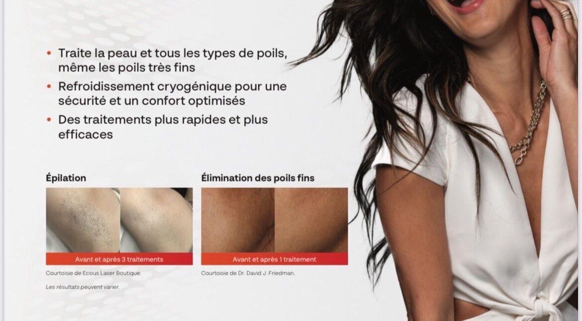 Traitement épilation avancé chez Beauté par Kristine, Laval, Québec, CA. Rapidité et efficacité garanties.