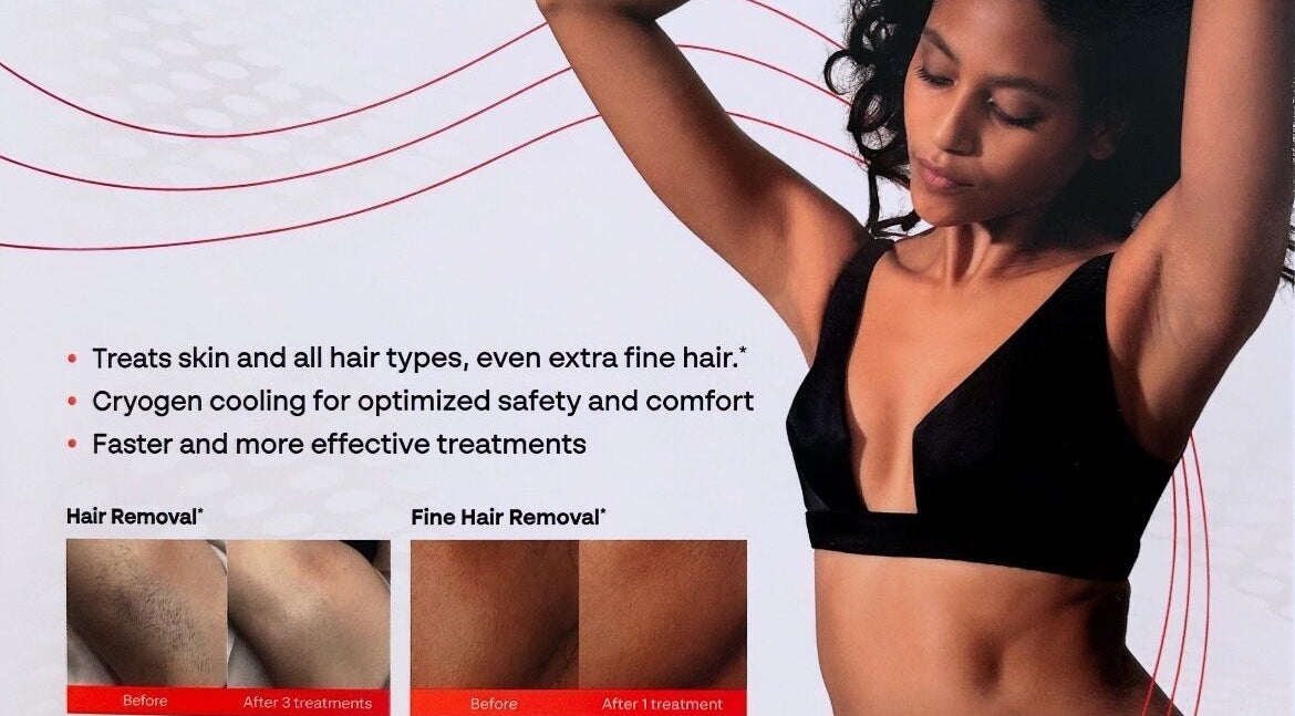 Traitements d'épilation avancés chez Beauté par Kristine, Laval, Québec, CA, affichant résultats avant-après.