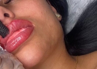 Close-up of lip treatment at LabtoLips in Halstead, England, GB. Enhancing lip beauty through skilled artistry.
