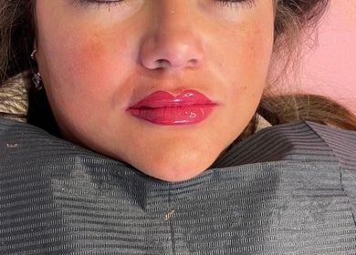 Close-up of glossy lips after a beauty treatment at LabtoLips, Halstead, England, GB.