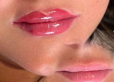 Glossy lips treatment at Labtolips Chelmsford, enhancing natural beauty in Chelmsford, England, GB.