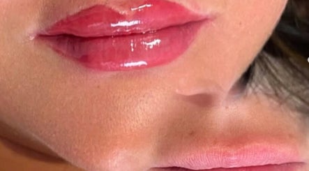 Glossy lips treatment at Labtolips Chelmsford, enhancing natural beauty in Chelmsford, England, GB.