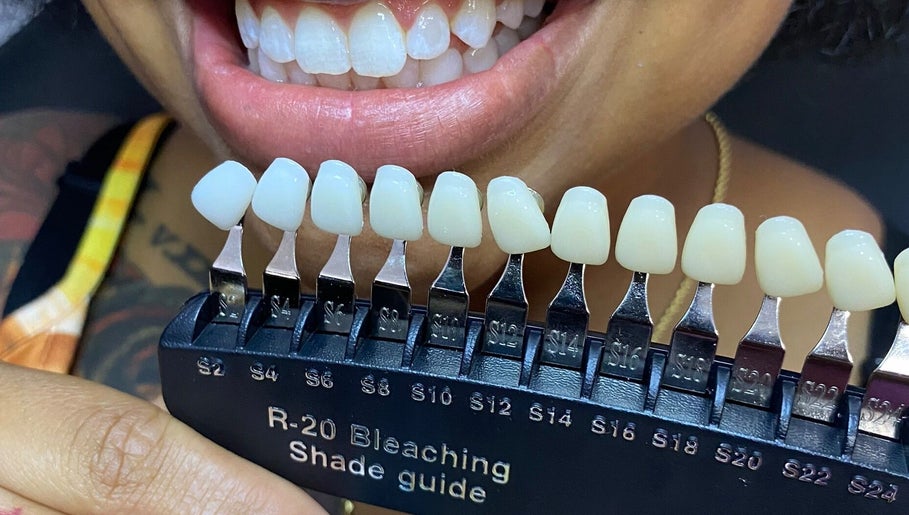 Cosmetic Teeth Whitening 910 image 1