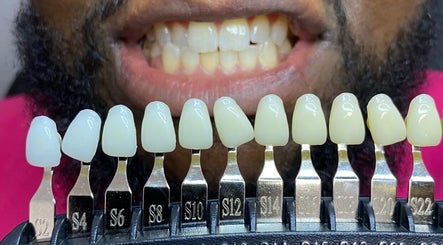 Cosmetic Teeth Whitening 910 image 2