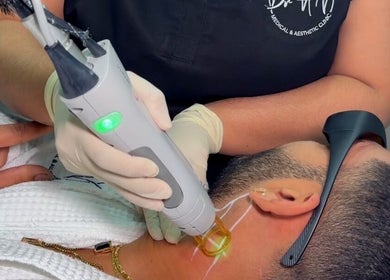 Laser treatment at Dr Avinash Nath Maraval Office, Port Of Spain, Diego Martin Regional Corporation, TT.
