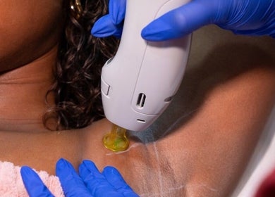 Laser treatment at Dr Avinash Nath Maraval Office in Port Of Spain, Diego Martin Regional Corporation, TT.