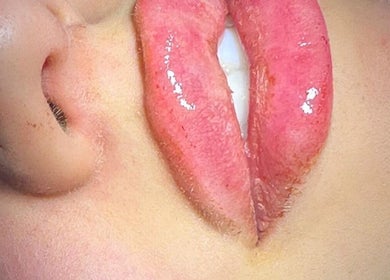 Closeup of glossy, enhanced lips at Venus clinic, London, England, GB. Aesthetic beauty and wellness focus.