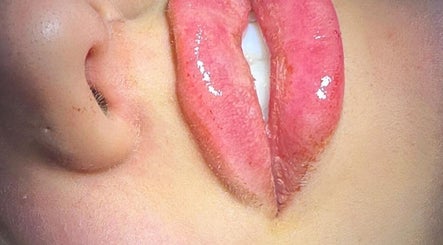 Closeup of glossy, enhanced lips at Venus clinic, London, England, GB. Aesthetic beauty and wellness focus.