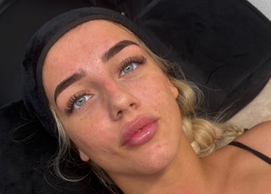 Fresh face post-treatment at Pure Aura Studio, Hindley Green, England, GB showcasing enhanced beauty.