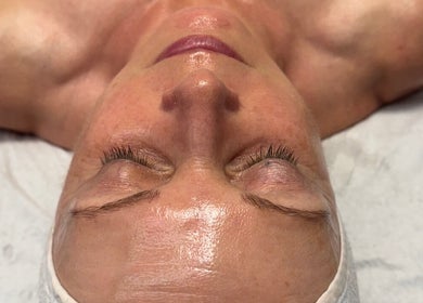 Facial treatment at Luminous Skin Clinic, Letterkenny, County Donegal, IE for glowing skin care results.