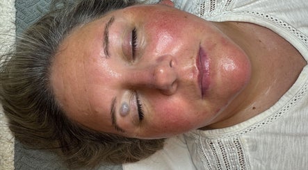 Woman receiving skincare treatment at Luminous Skin Clinic, Letterkenny, County Donegal, IE.