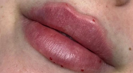 Mels Aesthetics, bilde 2