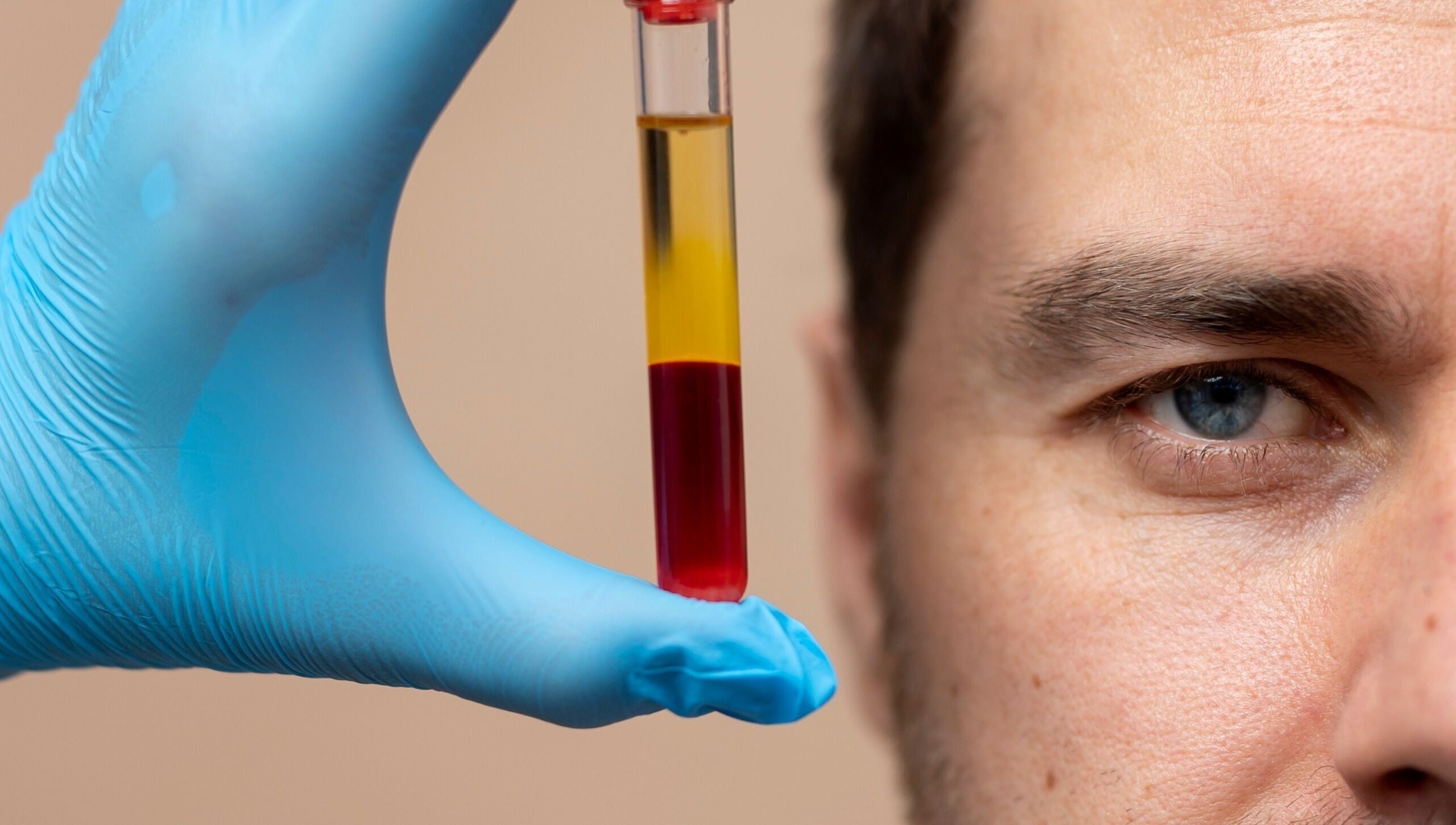 Close-up of blood sample in a gloved hand at Roots & Radiance, Aberdeen, Scotland, GB.