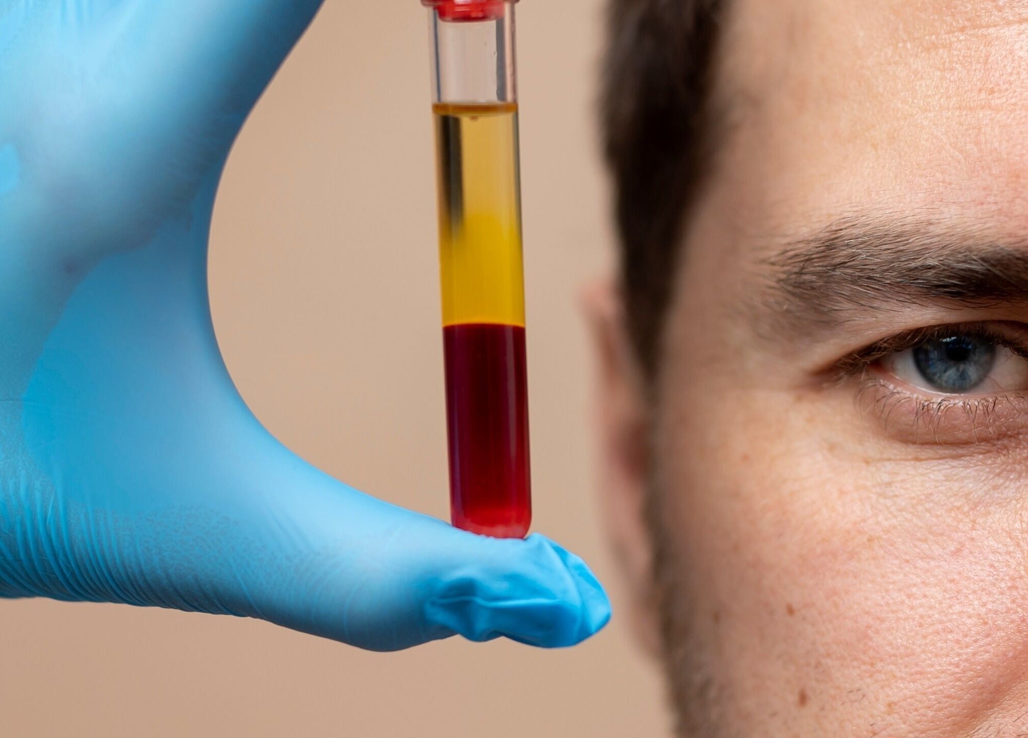 Close-up of blood sample in a gloved hand at Roots & Radiance, Aberdeen, Scotland, GB.