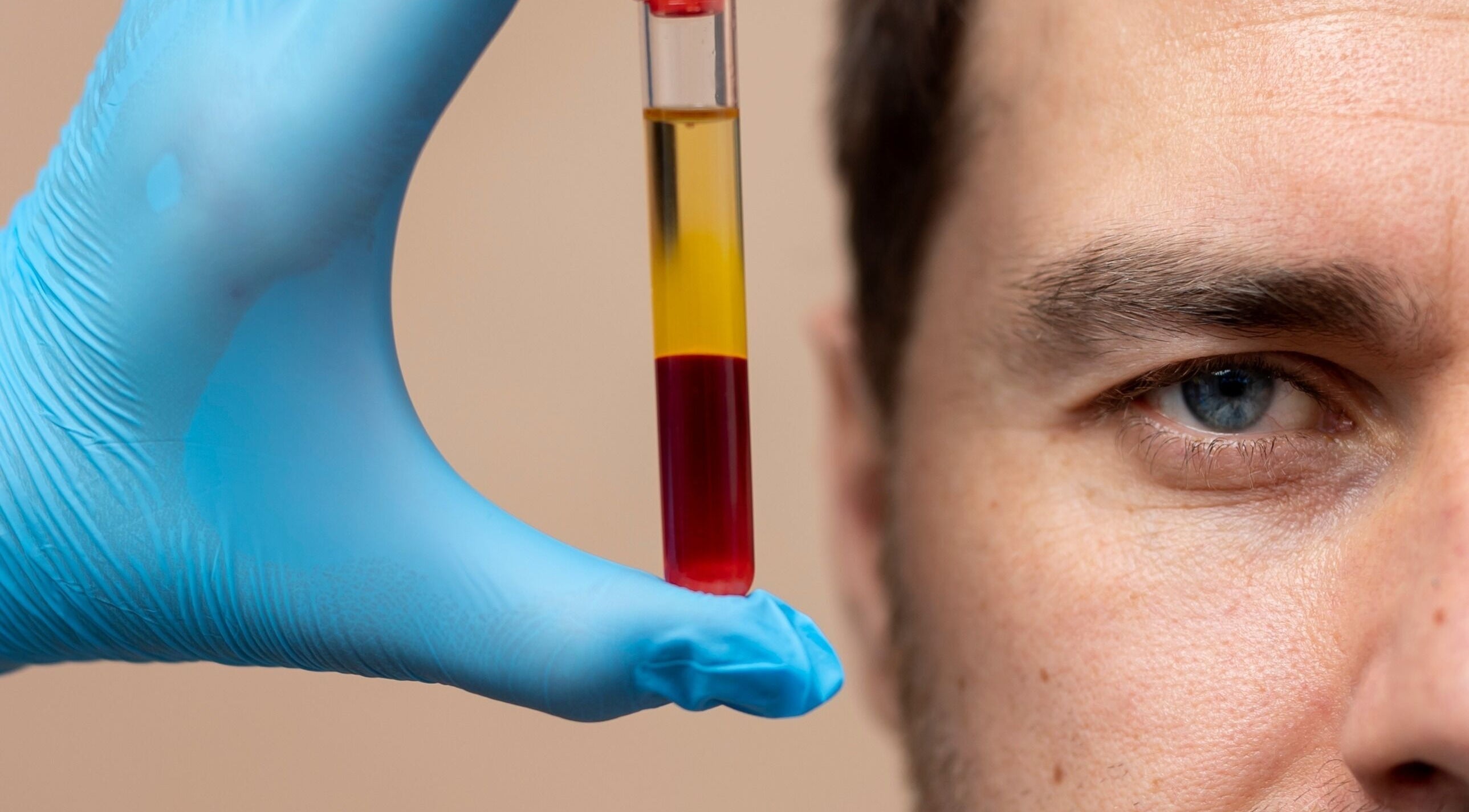 Close-up of blood sample in a gloved hand at Roots & Radiance, Aberdeen, Scotland, GB.