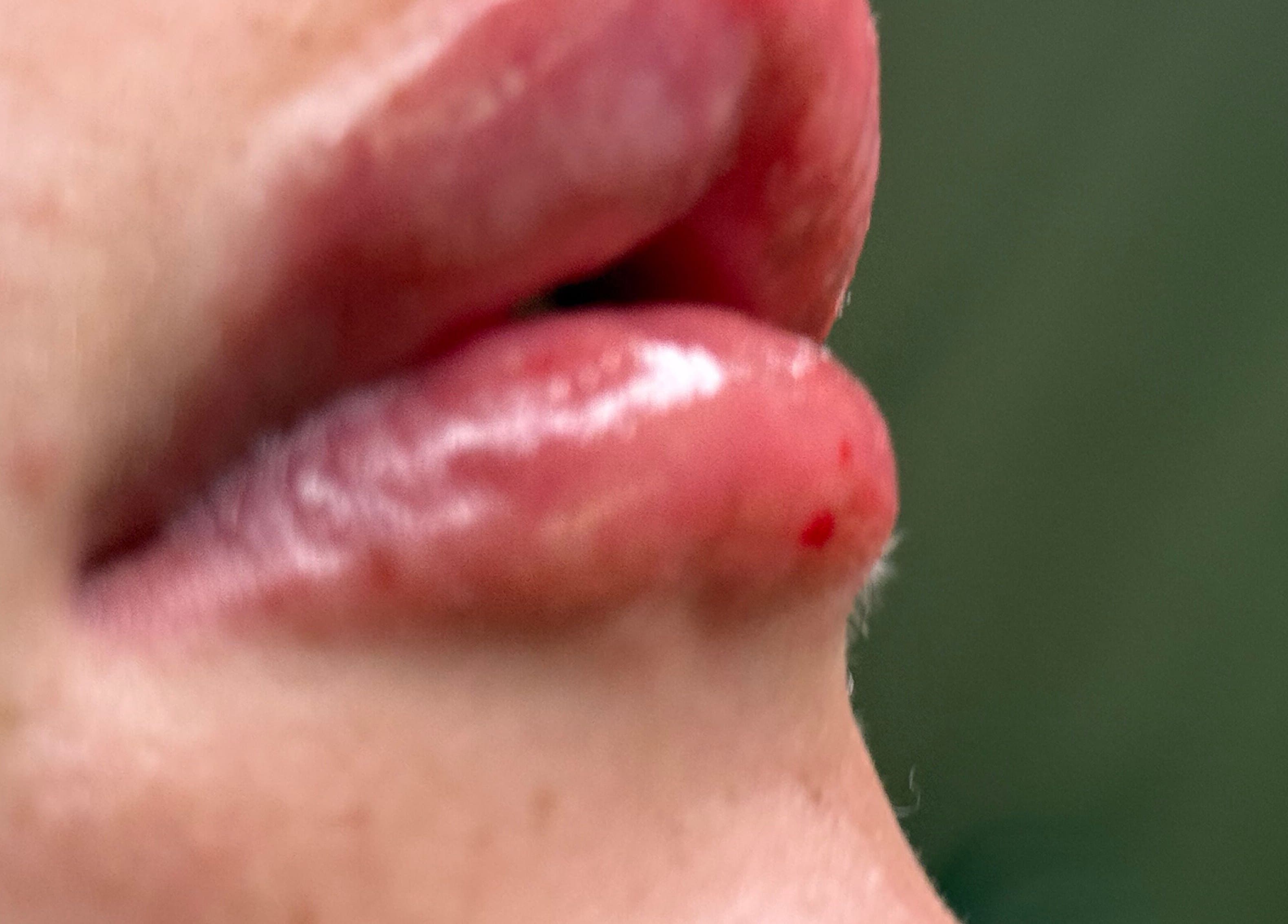 Close-up of lips showcasing lip enhancement at Love Mi Aesthetics in Weymouth, England, GB.