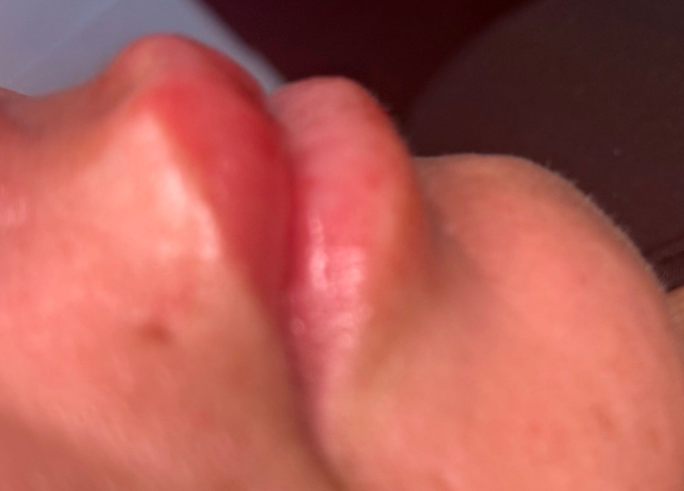 Close-up of enhanced lips at Love Mi Aesthetics, Weymouth, England, GB showcasing beauty treatment.