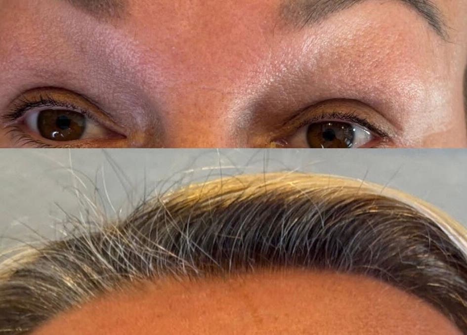 Eyebrow enhancement at Love Mi Aesthetics in Weymouth, England, GB, showcasing meticulous detail and precision.