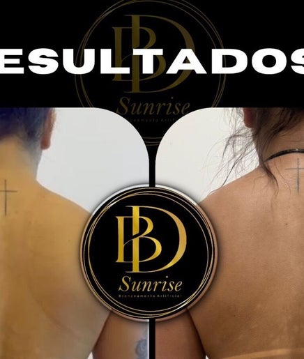 Resultados de beleza no BD Sunrise, Santa Catarina, Brasil. Antes e depois de tratamento estético.