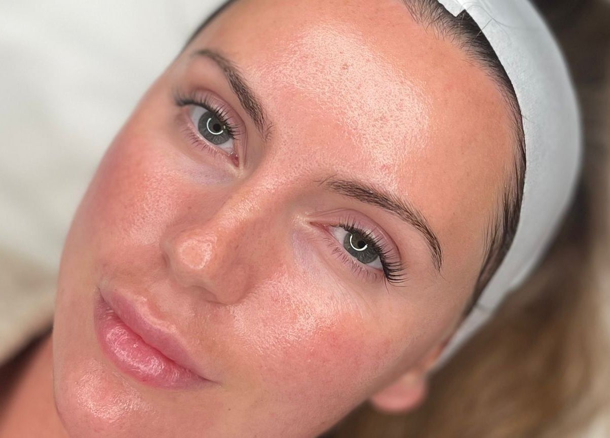 Rejuvenated client after facial at Glow By Molly, Tywyn, Wales, GB, showcasing smooth and glowing skin.