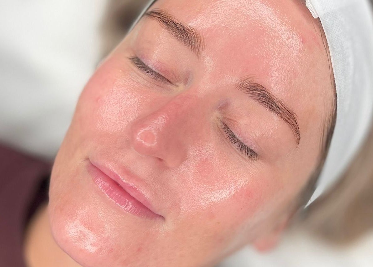 Close-up of a serene face with glowing skin during a facial at Glow By Molly, Tywyn, Wales, GB.