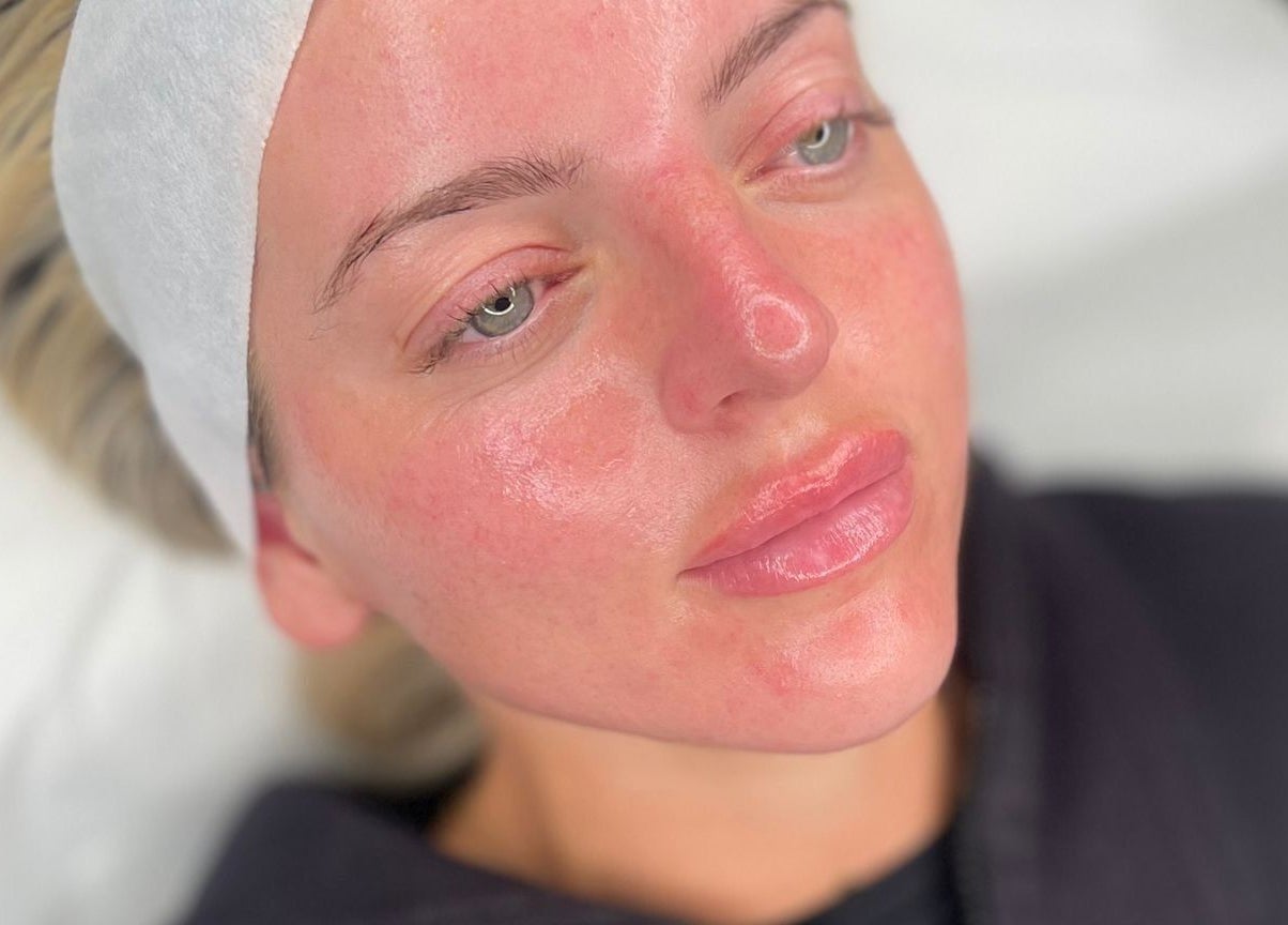 Close-up of glowing skin after facial at Glow By Molly, Tywyn, Wales, GB.