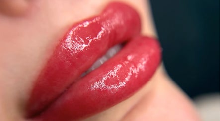 Close-up of vibrant, glossy lips treated at Narce, West End, Queensland, AU, showcasing expert beauty care.