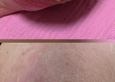 Expert foot care at Health And Beauty At Your Door, Easingwold, England, GB, showcasing rejuvenated skin.