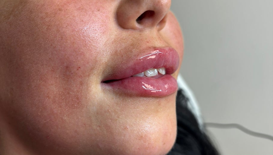 Close-up of glossy lips with a fresh enhancement at Ally’s Aesthetics in Glasgow, Scotland, GB.