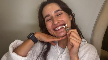 High on Smile Teeth Whitening image 2
