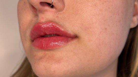 Dr Bianca Medical Aesthetics