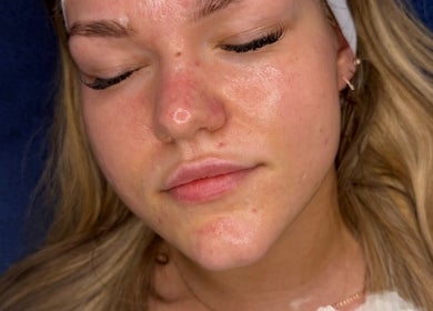 Experience glowing skin after facial at Your Dream Glow, Manchester, England, GB. Rejuvenation at its finest.