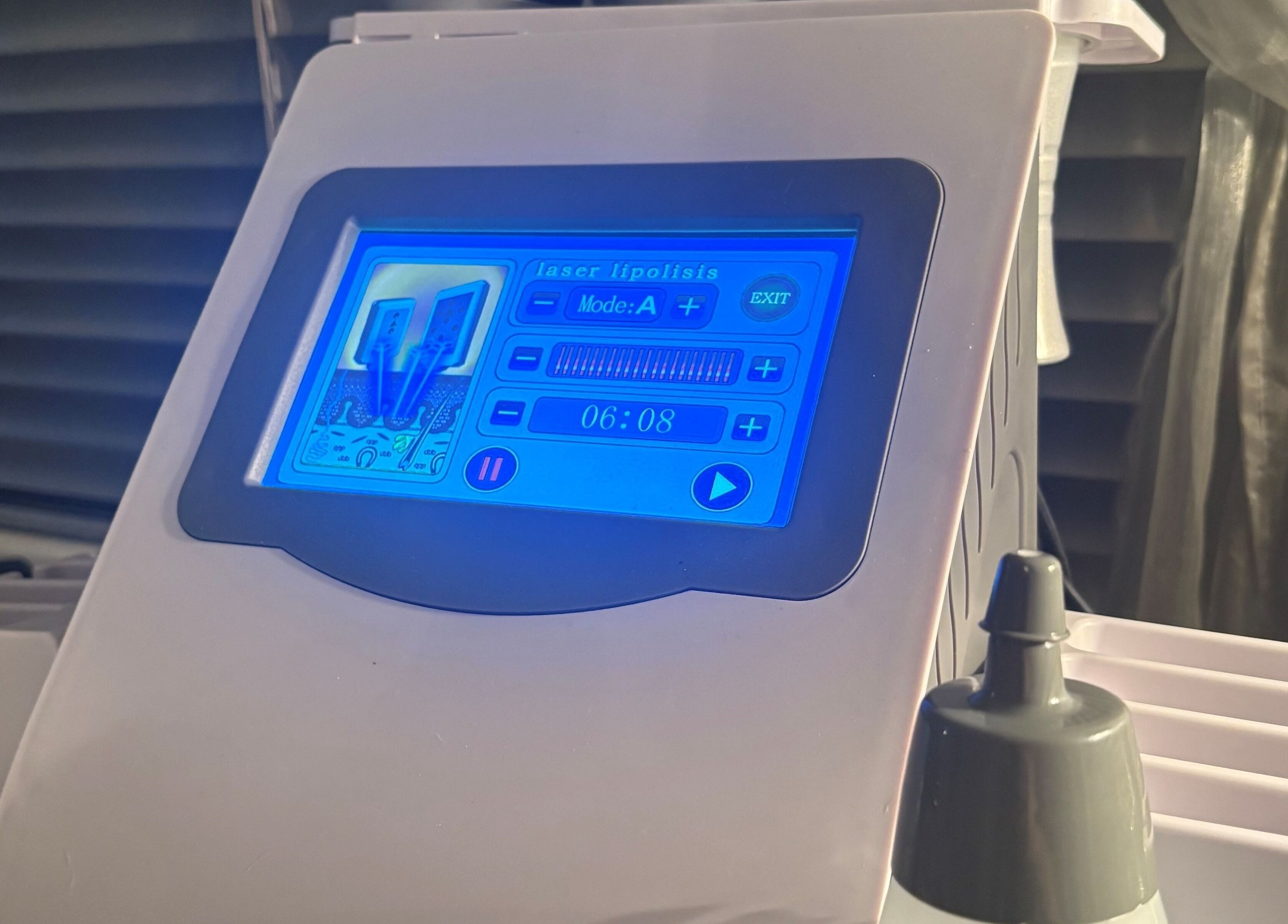 Advanced laser lipolysis machine at Sculpte Society, Warnbro, Western Australia, AU for precise body contouring.